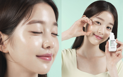 Dùng retinol nhưng da không bị bong tróc mà còn căng mịn nõn nà hóa ra là nhờ có “trùm cuối skincare” này đây