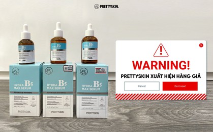 Thương hiệu mỹ phẩm Prettyskin khuyến cáo khách hàng thận trọng để không mua phải hàng giả hàng nhái