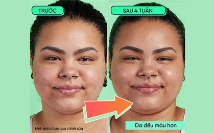 Chuyên gia da liễu 17,9 triệu người theo dõi khuyên dùng retinol thân thiện với mọi loại da của INNISFREE