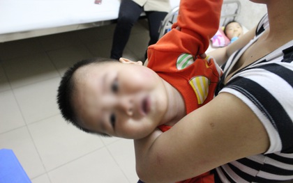 Một cháu bé ở Đà Nẵng nhập viện nghi bị đánh tại nhà trẻ tự phát