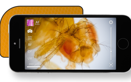 Thêm khả năng soi vi khuẩn cho smartphone với ống kính μPeek