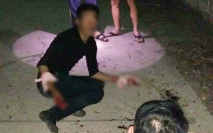 Trộm chó giữa đêm, nam thanh niên bị chém nát hai bàn tay