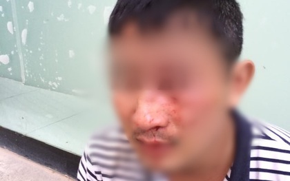 Vì 30.000 đồng, người đàn ông ở Hà Nội cầm vợt tennis đánh shipper gãy mũi