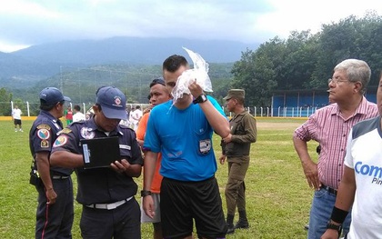 Trọng tài Guatemala bị cầu thủ đánh dã man vì dám... rút thẻ đỏ