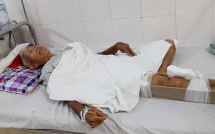 Vụ tài xế cán cụ ông gãy chân rồi bỏ chạy: "Tôi nằm nửa tiếng ngoài đường, chậm 10 phút là chết"