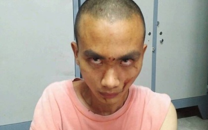 Nghi vấn đối tượng truy sát nhiều người trong chùa Bửu Quang có sử dụng chất kích thích
