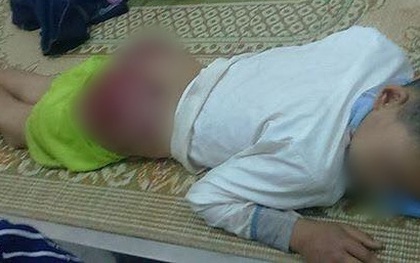 Hình ảnh gây phẫn nộ: Bé trai 13 tuổi bị cha ruột đánh tứa máu