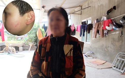 Gia đình bức xúc khi nghe cậu bé lớp 4 kể lại chuyện bị cô giáo cho 42 bạn tát vào mặt