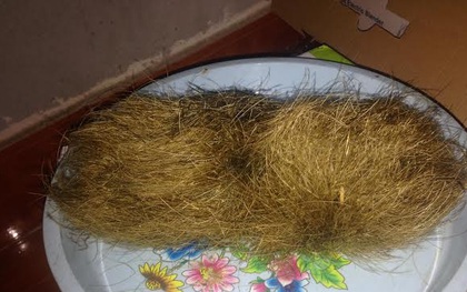 Vĩnh Phúc: Mổ lợn thấy "trứng vàng' nghi cát lợn tiền tỷ