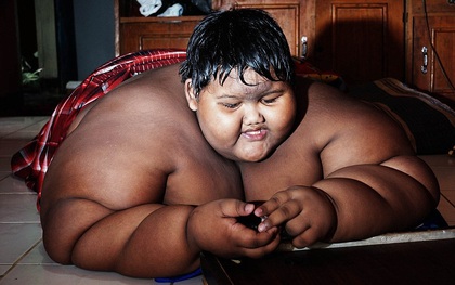 Cuộc sống nặng nề của cậu bé mới 10 tuổi mà đã nặng 190kg