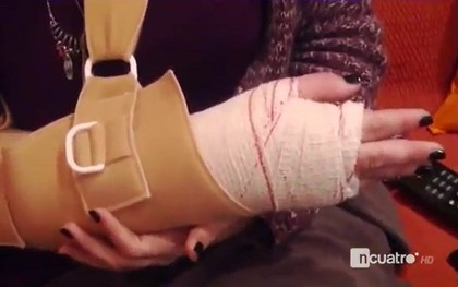 Cú sút sấm sét của Messi làm gãy tay fan nữ hâm mộ Ronaldo