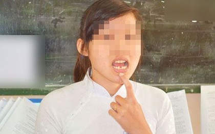 2 lần từ chối lời mời đi chơi bị bạn trai đánh "rớt răng"