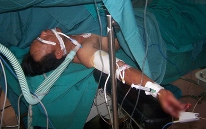 Người đàn ông bị chém rớt cánh tay xuống đất