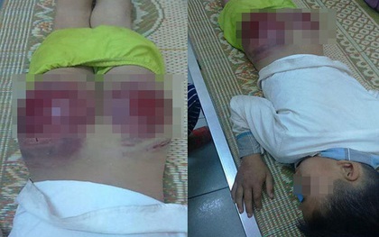 Bố đánh con tứa máu ở Thái Nguyên: Viết giấy cam kết về ở với mẹ