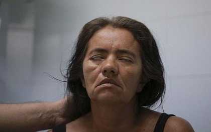 Phát hiện virus Zika có thể hủy hoại nghiêm trọng não người lớn