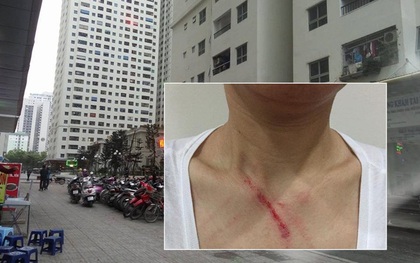 Hà Nội: Khuyên không nhổ nước bọt nơi công cộng, một phụ nữ bị đánh trong thang máy