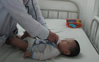 Hãi hùng phát hiện tụ điện trong phế quản bé 8 tháng tuổi