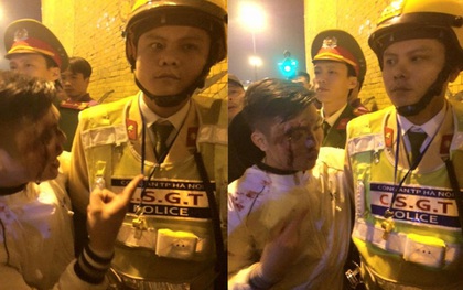 Hà Nội: Nam thanh niên bị ngã chảy máu mặt, gọi người nhà đến uy hiếp CSGT