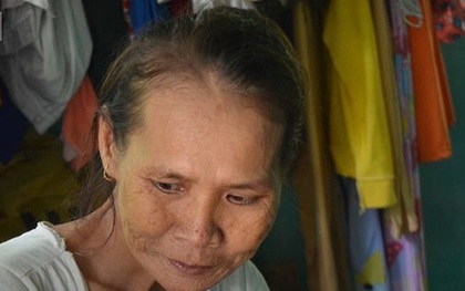 Quảng Nam: Người vợ hơn 30 năm không ngủ, chồng sợ hãi trốn đi