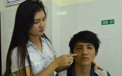 Thanh niên tự "đập mặt" vào gậy CSGT khiến hốc mắt bị lún