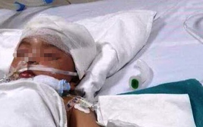 Bé gái 3 tuổi bị vợt cầu lông đâm xuyên não