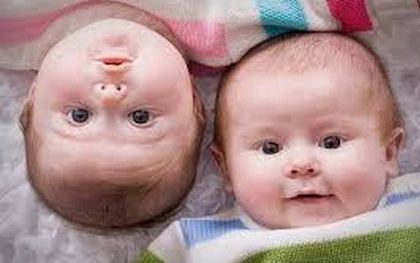 Hi hữu 2 bé gái sinh đôi nhưng khác cha