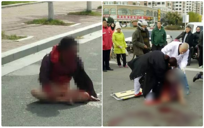 Người phụ nữ không mảnh vải che thân bị con trai đánh chảy máu mặt ngay giữa đường