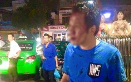 Cãi nhau với bảo vệ siêu thị lúc gửi xe, nam thanh niên bị đánh te tua