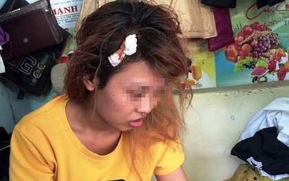 Bị đánh toác đầu vì không cho bạn chồng mượn phòng nhậu