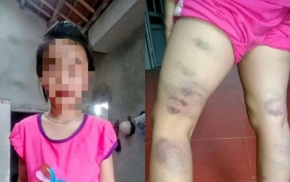 Phẫn nộ cô giáo bạo hành học sinh vì... viết sai chính tả