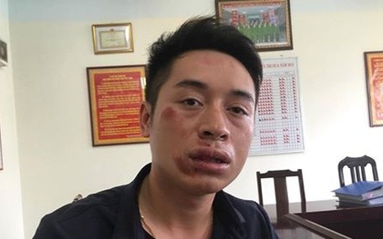 Khởi tố nam thanh niên đấm CSGT gãy hai răng cửa