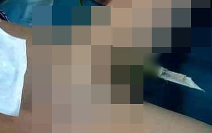 Lào Cai: Bé trai 9 tuổi bị cành nhãn dài 25cm đâm xuyên vùng kín