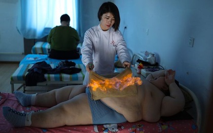 Dùng lửa đốt mỡ bụng, phương pháp giảm cân cho nhiều trẻ em béo phì tại Trung Quốc