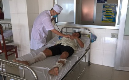 Một công an viên bị đốt khi đang ngủ