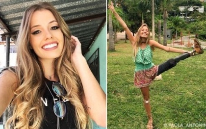 Mất 1 chân vì tai nạn, nhưng điều đó không ngăn cô người mẫu xinh đẹp này sống thật hạnh phúc!
