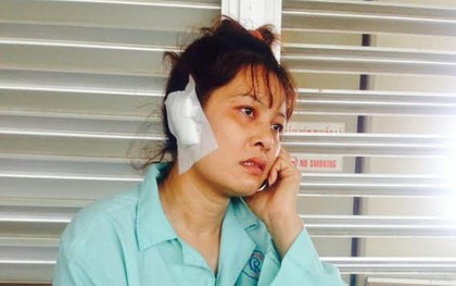 Một phụ nữ bị chồng cắn rớt tai