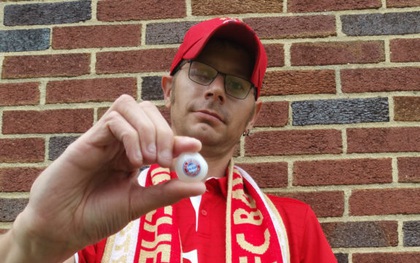 Fan cuồng Bayern Munich bị mù vì ung thư đeo mắt giả đặc biệt