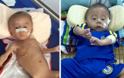 Đằng sau hình ảnh gây sốc về em bé "tim thủng lỗ" trong BV Nhi đồng 1