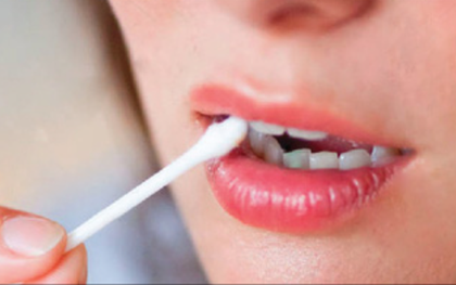 3 công thức cực đơn giản trị chảy máu chân răng tức thì từ dược liệu