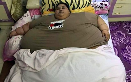 Cô gái to bằng cái giường nặng nửa tấn qua đời vì quá béo