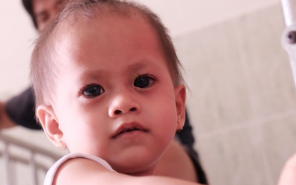 Những ngày sống trong lo sợ của cha mẹ bé gái có đôi mắt “xám tro” u ám