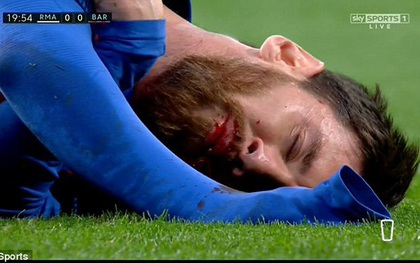 Xót xa nhìn cảnh Messi bị thúc cùi chỏ chảy máu mồm