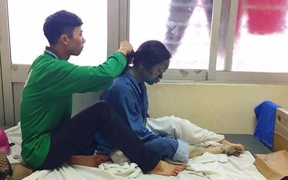 Bức ảnh dễ thương về chàng trai ngồi tết tóc cho người yêu bị thủy đậu: Yêu là luôn bên nhau cả khi xấu xí nhất