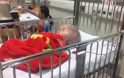 Sau thời gian chống chọi với bệnh tật, bé trai bị não úng thủy ở Thanh Hóa đã qua đời