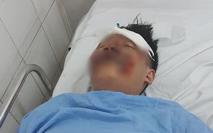 Tông trúng rồi kéo lê 2 nam sinh Đại học FPT gần 40m, tài xế chạy trốn bỏ mặc 2 nạn nhân nằm bất tỉnh giữa đường