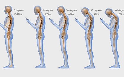 Chưa già mà đã hỏng cột sống là do 5 thói quen đang ngày càng phổ biến này