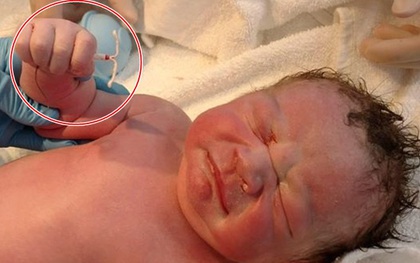 Sự thật phía sau bức ảnh bé sơ sinh nắm chặt vòng tránh thai khi chào đời gây bão mạng xã hội