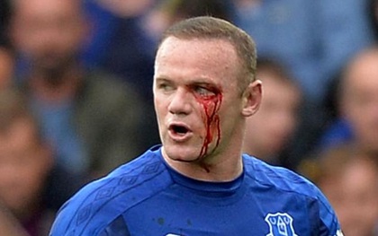 Rooney rách mắt, máu chảy thành dòng trên khuôn mặt
