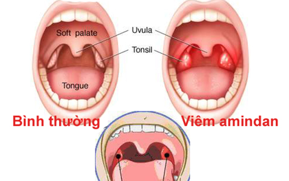 Hơi thở bỗng nhiên có mùi lạ, coi chừng cơ thể mắc các bệnh nguy hiểm