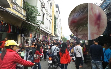 Hà Nội: Nữ sinh bị hành hung vì đi thử giày nhưng không mua ở chợ Nhà Xanh